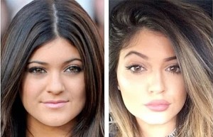 You guys, Kylie's face just CHANGED NATURALLY, okay?!