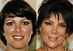 Kris Jenner has access to the best plastic surgeons. Let that sink in.